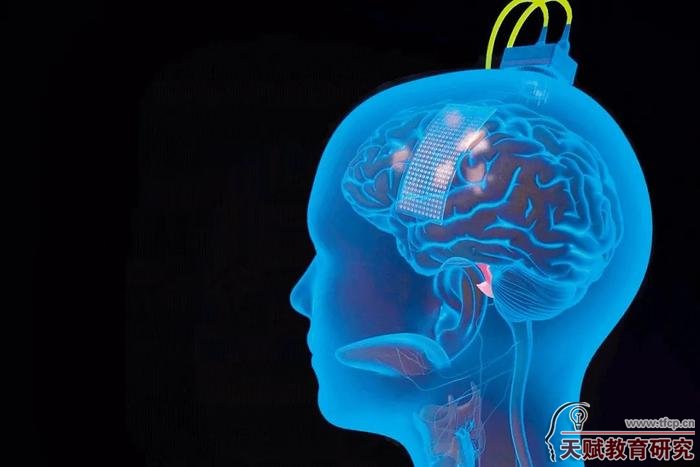 安的大腦表面植入了一個薄薄的矩形電極，以接收其試圖說話時發(fā)出的信號。圖/加州大學
